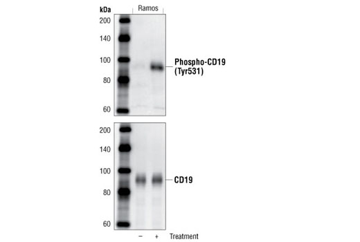 Western blot analysis of SDS extracts from untreated or anti-human IgM treated (12 µg/ml for 2 minutes) Ramos cells using Phospho-CD19 (Tyr531) Antibody (upper) and control CD19 Antibody #3574 (lower).