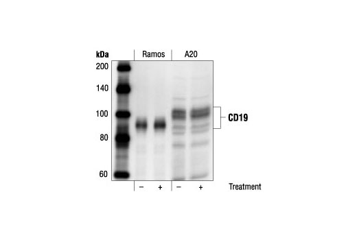 Western blot analysis of SDS extracts from untreated or anti-human IgM treated (12 µg/ml for 2 minutes) Ramos cells and untreated or anti-mouse IgG treated (30 µg/ml for 2 minutes) A20 cells, using control CD19 Antibody.