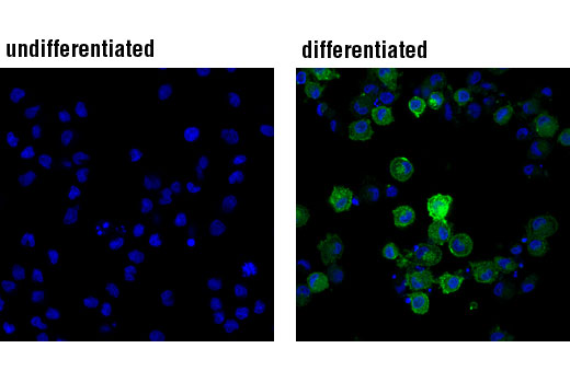 Confocal immunofluorescent analysis of MUTZ-3 cells, undifferentiated (negative, left) or differentiated (positive, right) into interstitial dendritic cells with Human Granulocyte Macrophage Colony Stimulating Factor (hGM-CSF) #8922 (100 ng/ml), Human Interleukin-4 (hIL-4) #8919 (100 ng/ml), and Human Tumor Necrosis Factor-α (hTNF-α) #8902 (2.5 ng/ml) for 7 d, using DC-SIGN (D7F5C) XP ® Rabbit mAb (green). Actin filaments were labeled with DyLight® 554 Phalloidin #13054 (red). Blue pseudocolor = DRAQ5® #4084 (fluorescent DNA dye).