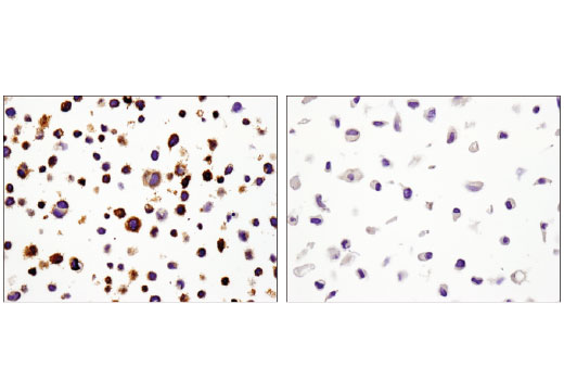 Immunohistochemical analysis of paraffin-embedded Karpas-299 (left) or PC-3 (right) cell pellets using PD-L1 (E1L3N ® ) XP ® Rabbit mAb.