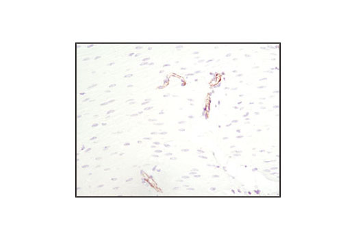 Immunohistochemical analysis of paraffin-embedded human smooth muscle using CD31 (PECAM-1) (89C2) Mouse mAb.