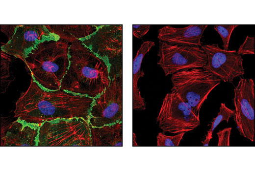 Confocal immunofluorescent analysis of HUVEC (left) and HeLa cells (right) using CD31 (PECAM-1) (89C2) Mouse mAb (green). Actin filaments have been labeled with DY-554 phalloidin (red). Blue pseudocolor = DRAQ5™ (fluorescent DNA dye).