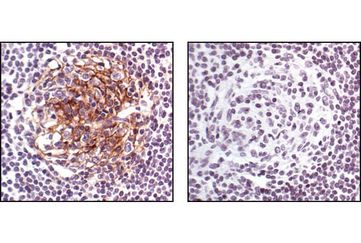 Immunohistochemical analysis of paraffin-embedded human lymph node using CD54/ICAM-1 Antibody in the presence of control peptide (left) or antigen specific peptide (right).
