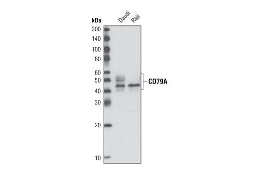 Western blot analysis of extracts from Raji and Daudi cell lines using CD79A Antibody.