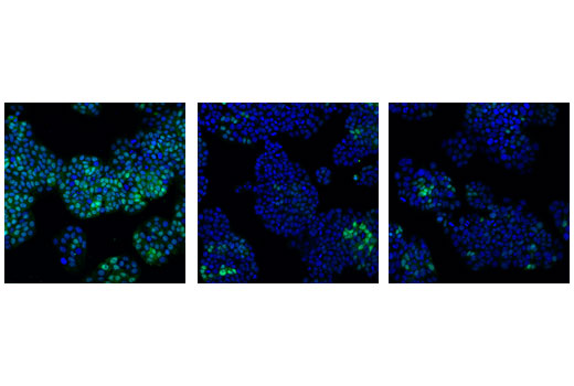 Confocal immunofluorescent analysis of HT-29 cells, transfected with SignalSilence® Control siRNA (Unconjugated) #6568 (left), SignalSilence® cdc2 siRNA I #3500 (center) or SignalSilence® cdc2 siRNA II #3600 (right), using cdc2 (POH1) Mouse mAb (green). Blue pseudocolor = DRAQ5® #4084 (fluorescent DNA dye).