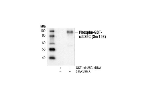 Western blot analysis of extracts from HeLa cells overexpressing full-length GST-cdc25C, untreated or treated with calyculin A #9902, using Phospho-cdc25C (Ser198) Antibody.