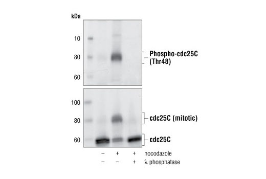 Western blot analysis of HT29 cell extracts untreated, nocodazole-treated, and λ phosphotase-treated using Phospho-cdc25C (Thr48), #9527 (upper), and cdc25C (5H9) Rabbit mAb (lower).
