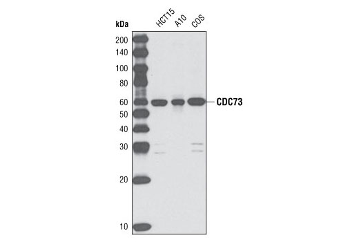 Western blot analysis of extracts from HCT15, A10 and COS cells using CDC73 (D410) Antibody.