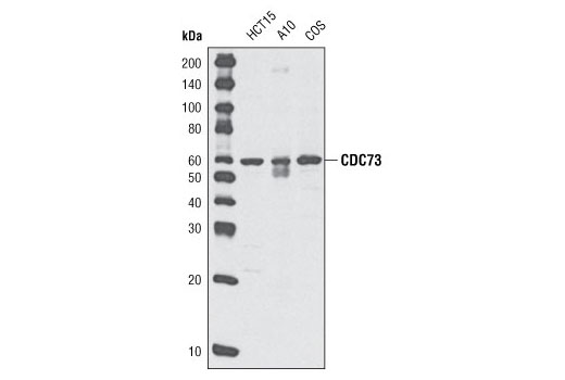 Western blot analysis of extracts from HCT15, A10 and COS cells using CDC73 (A264) Antibody.