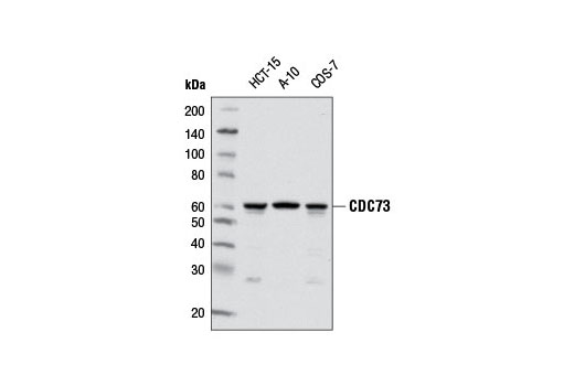 Western blot analysis of extracts from various cell lines using CDC73 (D38E12) Rabbit mAb.