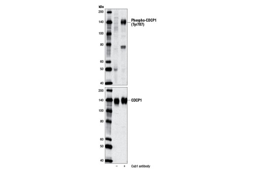 Western blot analysis of extracts of ZR-75-1 cells, untreated (-) or treated with a Cub1 antibody (+), using Phospho-CDCP1 (Tyr707) Antibody (upper) and CDCP1 Antibody #4115 (lower).