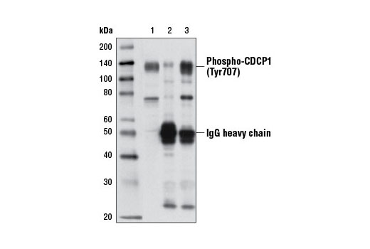 Immunoprecipitation of Phospho-CDCP1 (Tyr707) protein from ZR-75-1 cell extracts, treated with a Cub1 antibody, using Normal Rabbit IgG #2729 (lane 2) or Phospho-CDCP1 (Tyr707) Antibody (lane 3). Lane 1 is 10% input. Western blot analysis was performed using Phospho-CDCP1 (Tyr707) Antibody.