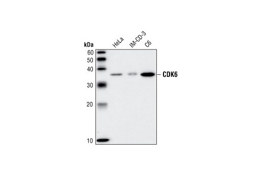 Western blot analysis of extracts from HeLa, IM-CD-3 and C6 cells, using CDK6 (DCS83) Mouse mAb.