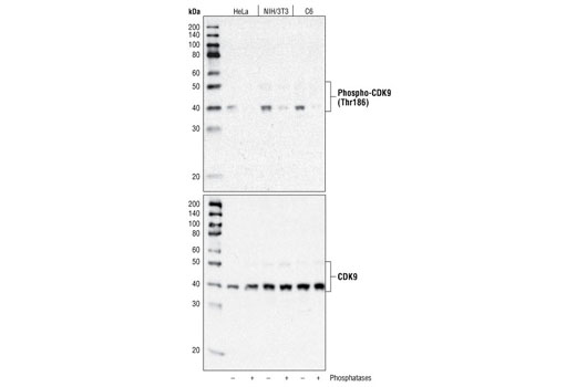 Western blot analysis of extracts from various cell types, untreated or treated with λ phosphatase and calf intestinal phosphatase (CIP), using Phospho-CDK9 (Thr186) Antibody (upper) or CDK9 (C12F7) Rabbit mAb #2316 (lower).
