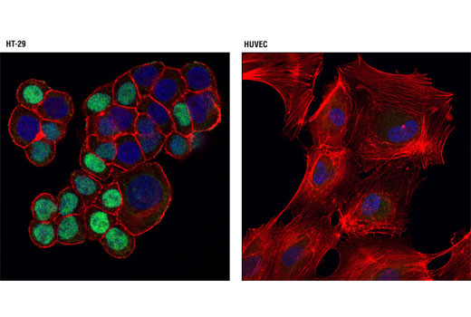 Confocal immunofluorescent analysis of HT-29 and HUVEC cells using CDT1 (D10F11) Rabbit mAb (green). Actin filaments were labeled with DY-554 phalloidin (red). Blue pseudocolor = DRAQ5 ® #4084 (fluorescent DNA dye).
