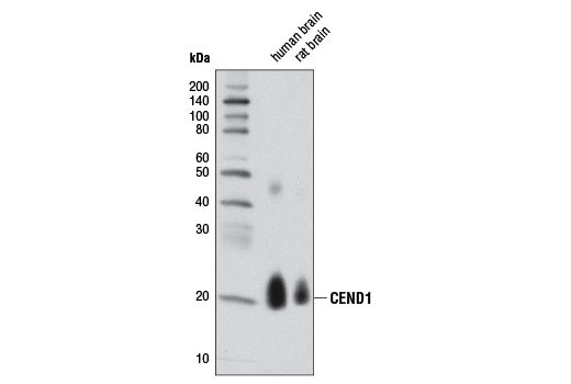 Western blot analysis of extracts from human and rat brain using CEND1 (D6A6) Rabbit mAb.