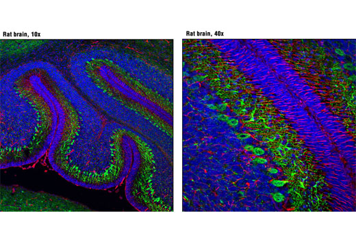 Confocal immunofluorescent analysis of P14 rat brain using CEND1 (D6A6) Rabbit mAb (green) and Nestin (Rat-401) Mouse mAb #4760 (red). Blue pseudocolor = DRAQ5 ® #4084 (fluorescent DNA dye).