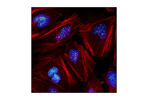 Confocal immunofluorescent analysis of HeLa cells using CENP-A Antibody (green). Actin filaments have been labeled with Alexa Fluor ® 555 phalloidin (red). Blue pseudocolor = DRAQ5® #4084 (fluorescent DNA dye).