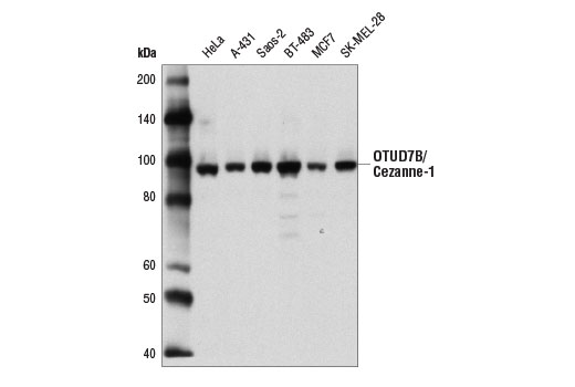 Western blot analysis of extracts from various cell lines using OTUD7B/Cezanne-1 Antibody.