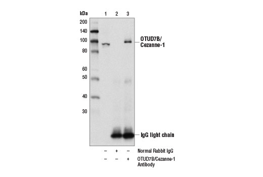 Immunoprecipitation of OTUD7B/Cezanne-1 from 293T cell extracts using Normal Rabbit IgG #2729 (lane 2) or OTUD7B/Cezanne-1 Antibody (lane 3). Lane 1 is 10% input. Western blot analysis was performed using OTUD7B/Cezanne-1 Antibody.