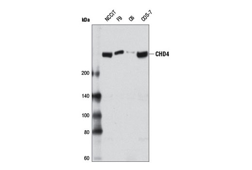 Western blot analysis of extracts from various cell lines using CHD4 (D8B12) Rabbit mAb.