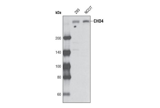 Western blot analysis of extracts from 293 and NCCIT cells using CHD4 Antibody.