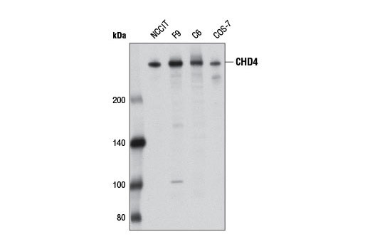 Western blot analysis of extracts from various cell lines using CHD4 (D4B7) Rabbit mAb.