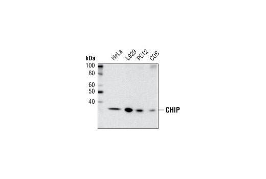 Western blot analysis of extracts from various cell lines using CHIP (C3B6) Rabbit mAb.