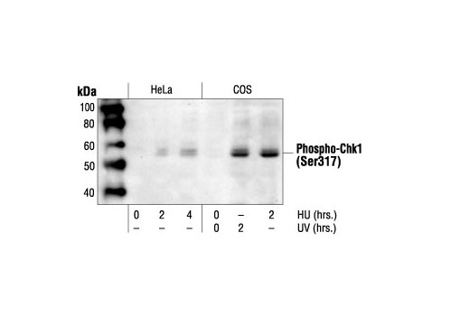 Western blot analysis of extracts from HeLa and COS cells treated with HU or UV as indicated, using Phospho-Chk1 (Ser317) Antibody.