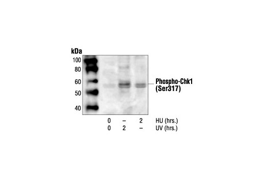Western blot analysis of extracts from Mv1Lu cells treated with UV or HU as indicated, using Phospho-Chk1 (Ser317) Antibody.