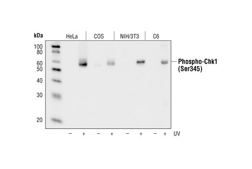 Western blot analysis of extracts from HeLa, COS, NIH/3T3 and C6 cells, untreated or UV-treated, using Phospho-Chk1 (Ser345) (133D30) Rabbit mAb.