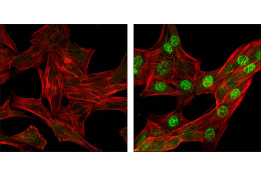 Confocal immunofluorescent analysis of C2C12 cells, untreated (left) or UV-treated (right), using Phospho-Chk1 (Ser345) (133D3) Rabbit mAb (green). Actin filaments have been labeled with DY-554 phalloidin (red).