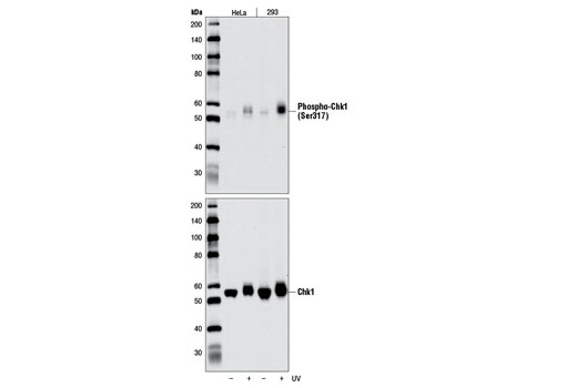 Western blot analysis of extracts from HeLa or 293 cells, untreated (-) or treated with UV (100 mJ) (+), using Phospho-Chk1 (Ser317) (D7H2) Rabbit mAb (upper) or Chk1 (2G1D5) Mouse mAb #2360 (lower).