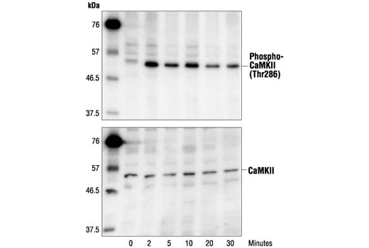 Western blot analysis of extracts from Neuro2A cells treated with calcium ionophore (A23187, 2 µM) after a 20-minute preincubation with forskolin (30 μM), using Phospho-CaMKII (Thr286) Antibody (upper) or CaMKII Antibody #3362 (lower).
