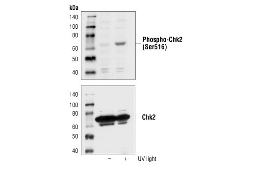 Western blot analysis of extracts from 293 cells, untreated or UV-treated (50 mJ/cm2, 2hrs), using Phospho-Chk2 (Ser516) Antibody (upper) or Chk2 Antibody #2662 (lower).