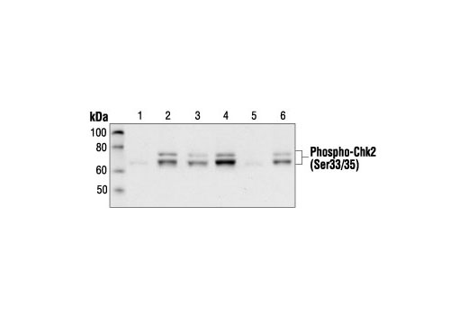 Western blot analysis of extracts from COS cells, untransfected (lane 1) or transfected with Wild-type Chk2 (lane 2), Chk2 (S19A) (lane 3), Chk2 (T26S28A) (lane 4), Chk2 (S33S35A) (lane 5) or Chk2 (T68A) (lane 6), using Phospho-Chk2 (Ser33/35) Antibody.