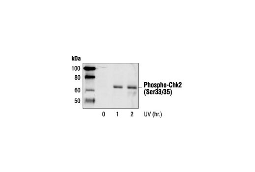 Western blot analysis of extracts from HeLa cells treated with UV for the indicated times, using Phospho-Chk2 (Ser33/35) Antibody.