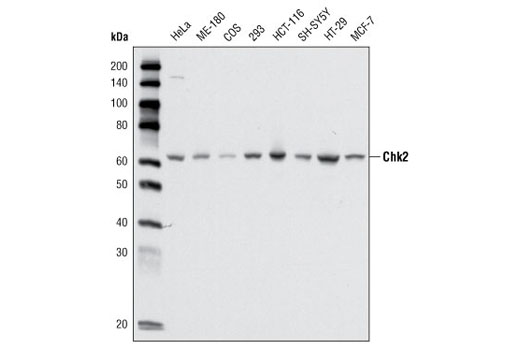 Western blot analysis of extracts from various cell types using Chk2 (1C12) Mouse mAb.