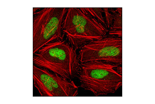 Confocal immunofluorescent analysis of HeLa cells using Chk2 (1C12) Mouse mAb (green). Actin filaments have been labeled with DY-554 phalloidin (red).
