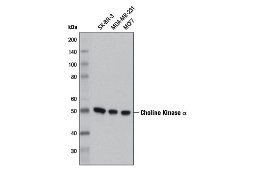 Western blot analysis of extracts from SK-BR-3, MDA-MB-231 and MCF7 cells using Choline Kinase α (D5X9W) Rabbit mAb.