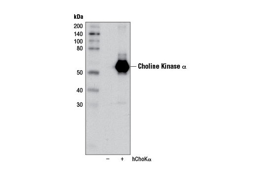 Western blot analysis of extracts from 293T cells, mock transfected (-) or transfected with a construct expressing full-length human choline kinase α (hChoKα; +) protein, using Choline Kinase α (D5X9W) Rabbit mAb.