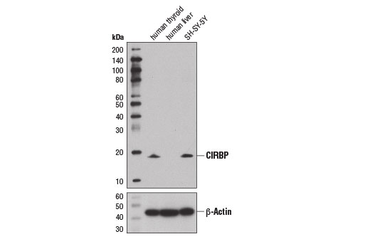 Western blot analysis of extracts from human thyroid, human liver, and SH-SY-5Y cells using CIRBP Antibody (upper) and β-Actin (D6A8) Rabbit mAb #8457 (lower).