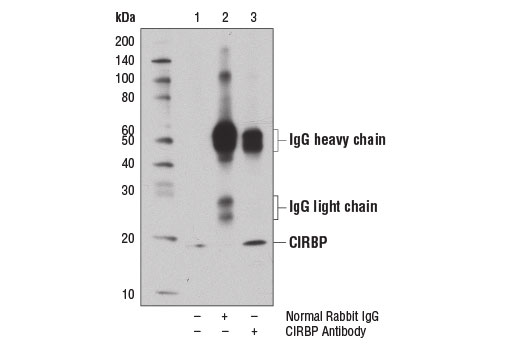 Immunoprecipitation of CIRBP from SH-SY-5Y cell extracts using Normal Rabbit IgG #2729 (lane 2) or CIRBP Antibody (lane 3). Lane 1 is 10% input. Western blot analysis was performed using CIRBP Antibody.