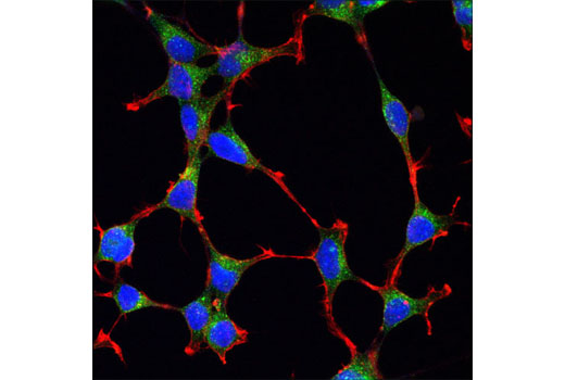 Confocal immunofluorescent analysis of SH-SY5Y cells using Clathrin Heavy Chain (D3C6) XP ® Rabbit mAb (green). Actin filaments were labeled with DY-554 phalloidin (red). Blue pseudocolor = DRAQ5 ® #4084 (fluorescent DNA dye).