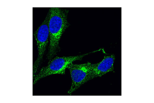 Confocal immunofluorescent analysis of HeLa cells labeled with Clathrin Heavy Chain (P1663) Antibody (green). Blue pseudocolor = DRAQ5™ (fluorescent DNA dye).
