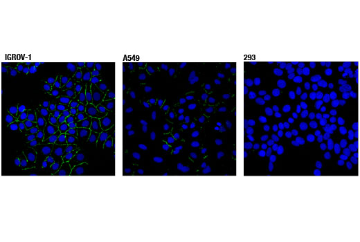 Confocal immunofluorescent analysis of IGROV-1 (positive, left), A549 (positive, center), and 293 (negative, right) cells using Claudin-1 (D3H7C) Rabbit mAb (green). Blue pseudocolor = DRAQ5 ® #4084 (fluorescent DNA dye).