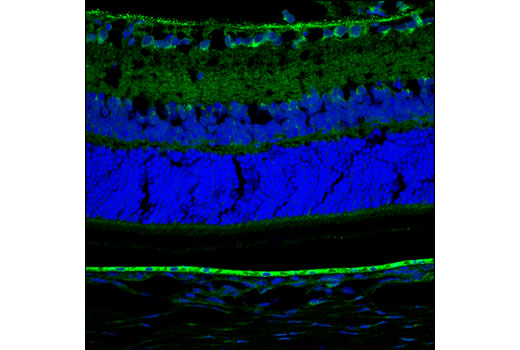 Confocal immunofluorescent analysis of normal rat retina using CLCN3 (D8Y5Q) Rabbit mAb (green). Blue pseudocolor = DRAQ5 ® #4084 (fluorescent DNA dye).