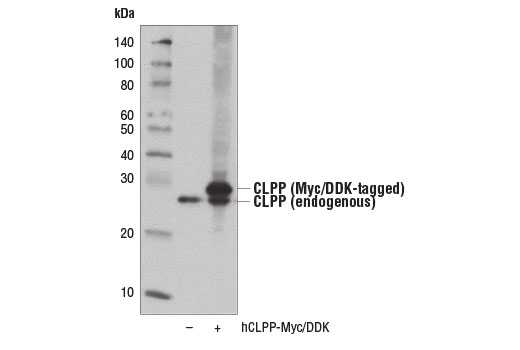 Western blot analysis of extracts from 293T cells, mock transfected (-) or transfected with a construct expressing Myc/DDK-tagged full-length human CLPP protein (hCLPP-Myc/DDK; +), using CLPP Antibody.