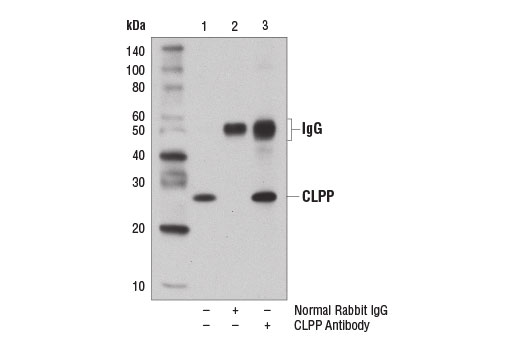 Immunoprecipitation of CLPP from A172 cell extracts using either Normal Rabbit IgG #2729 (lane 2) or CLPP Antibody (lane 3). Lane 1 is 10% input. Western blot analysis was performed using CLPP Antibody.