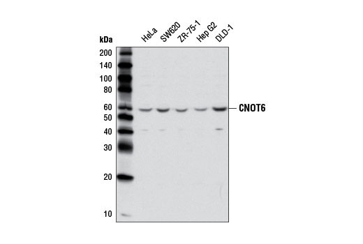Western blot analysis of extracts from various cell lines using CNOT6 (E1L8F) Rabbit mAb.